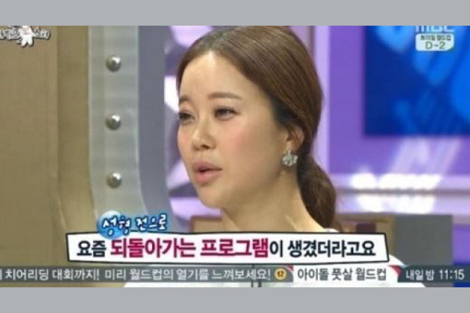 韓国 整形 二重 二重整形 二重手術 芸能人 アイドル 目 埋没 美人 韓国情報 韓国文化