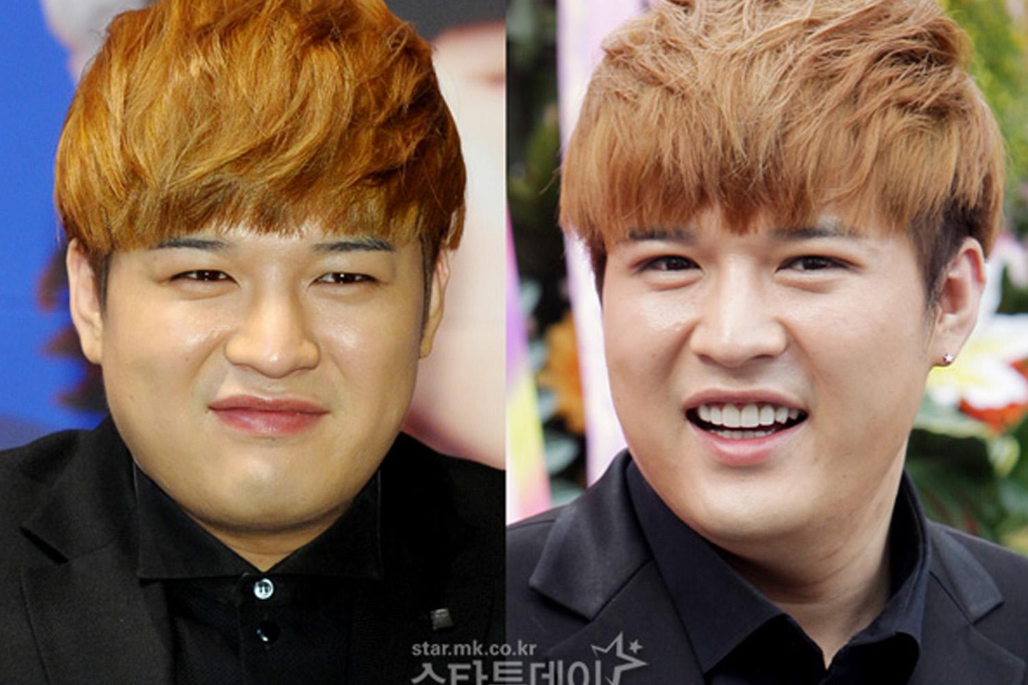 韓国 整形 二重 二重整形 二重手術 芸能人 アイドル 目 埋没 美人 韓国情報 韓国文化