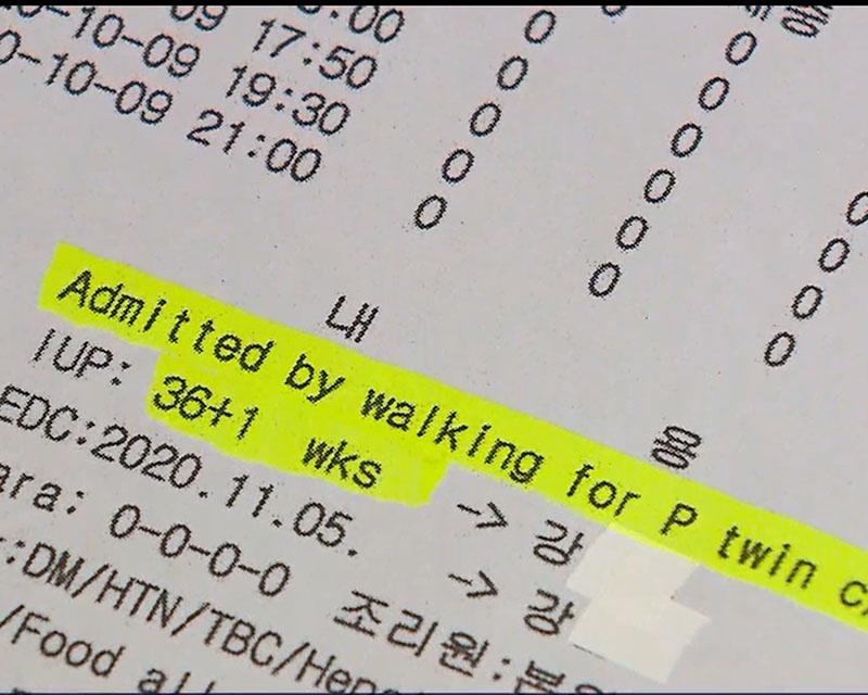 ตั้งครรภ์ 36 สัปดาห์