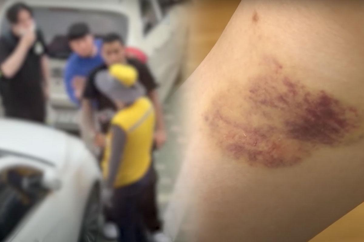 ทำร้ายร่างกาย