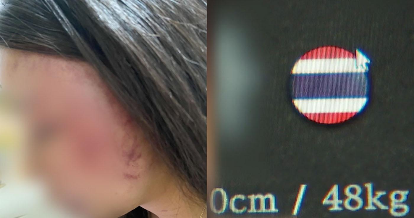 หญิงไทยถูกกักขังและทำร้ายร่างกายในสถานค้าประเวณี
