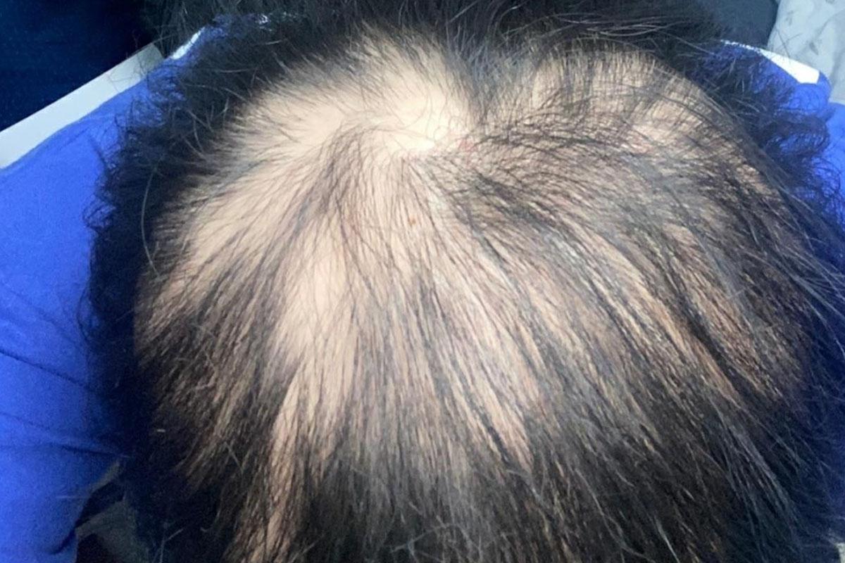 วัคซีนโควิด