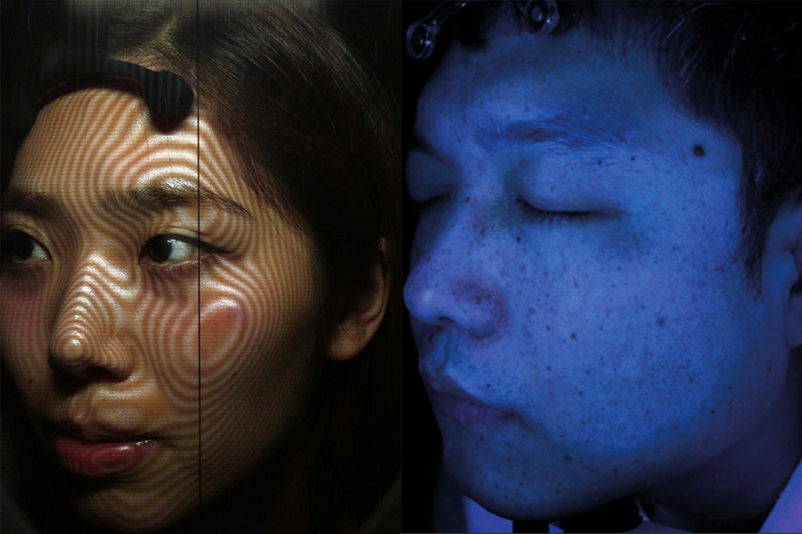 韓國 弘大醫美 推薦 首爾玻尿酸施打 韓國打肉毒 皮膚管理 雷射去痘 去斑 推薦價格 2025 預約