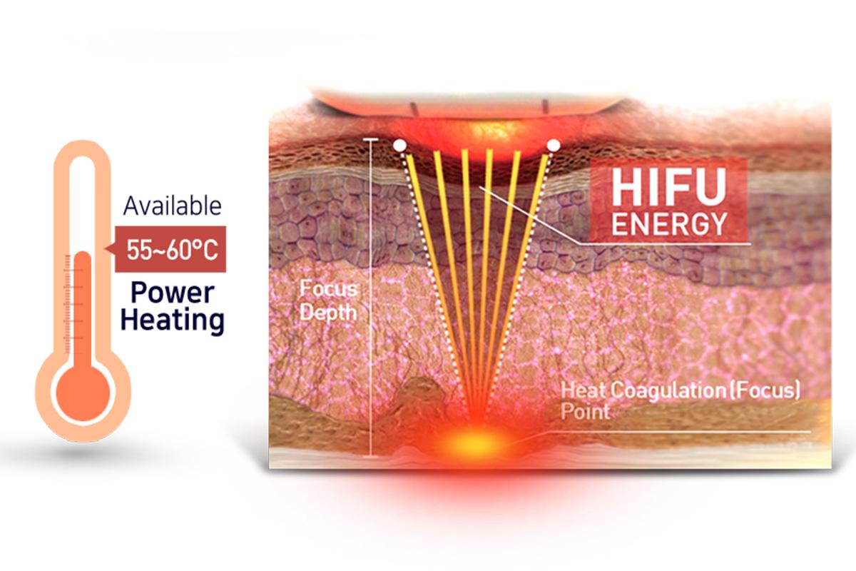 韓国 韓国旅行 韓国美容 韓国産婦人科 韓国皮膚科 ソウル 明洞 ミョンドン 韓国スキンケア THE CLIM Clinic