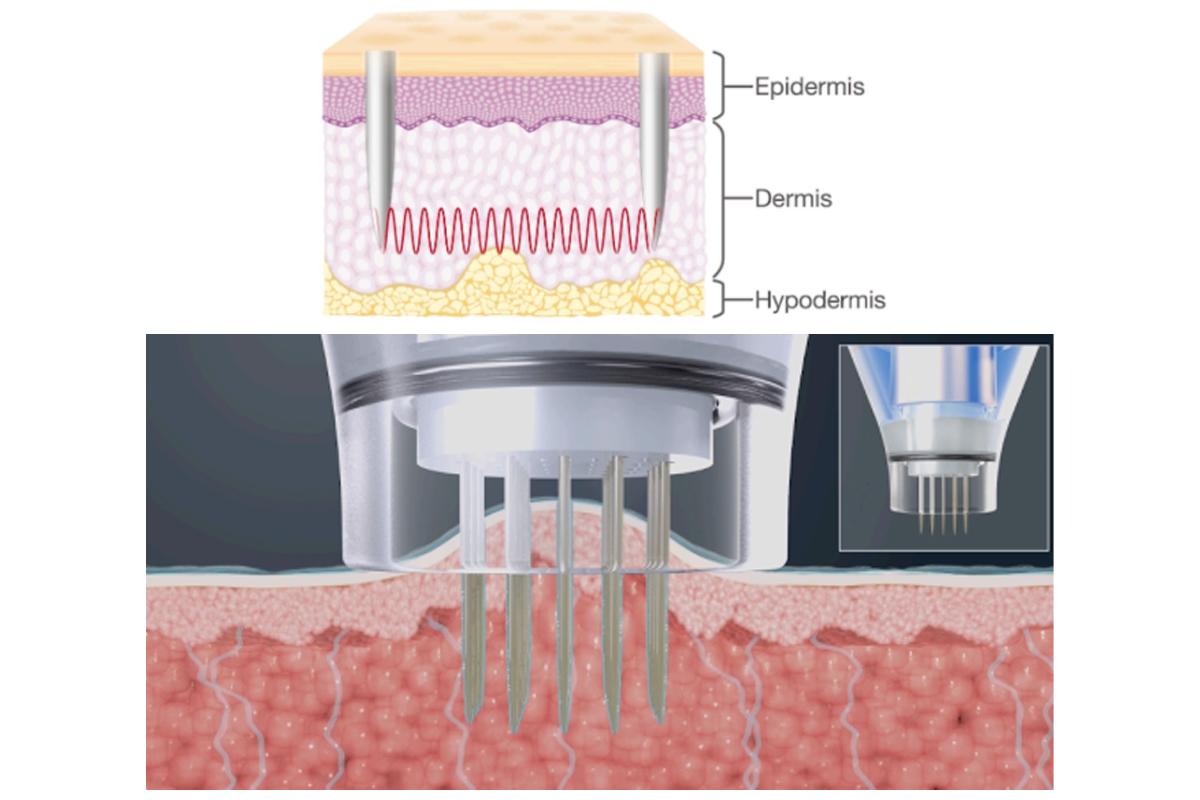 韓国旅行 韓国美容 明洞 THE CLIM Clinic 韓国美容皮膚科 韓国産婦人科 韓国ビューティー
