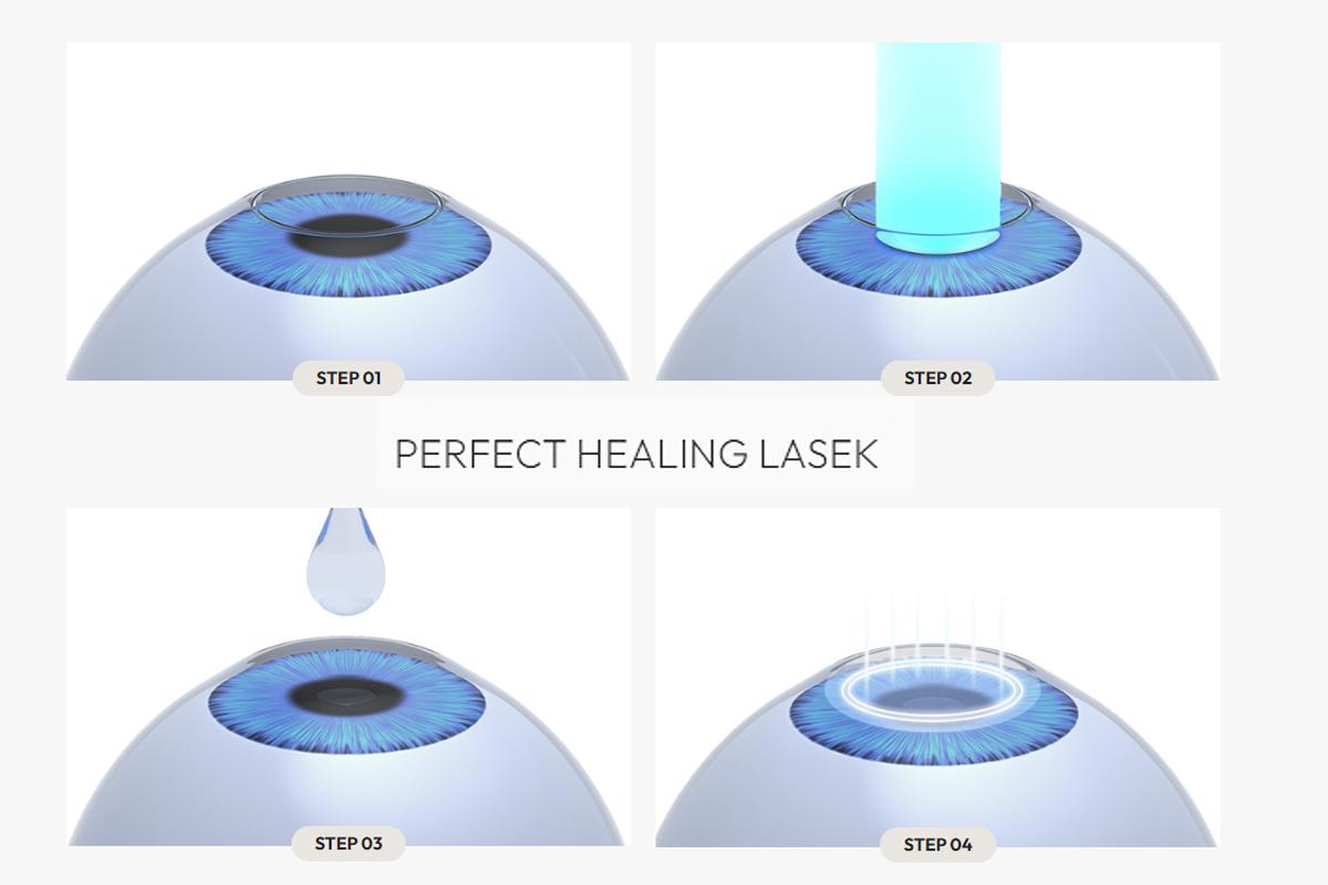 韓国旅行 韓国美容 韓国眼科 韓国ラシック 韓国ラセック HEALYNG 眼科 江南 ソウル