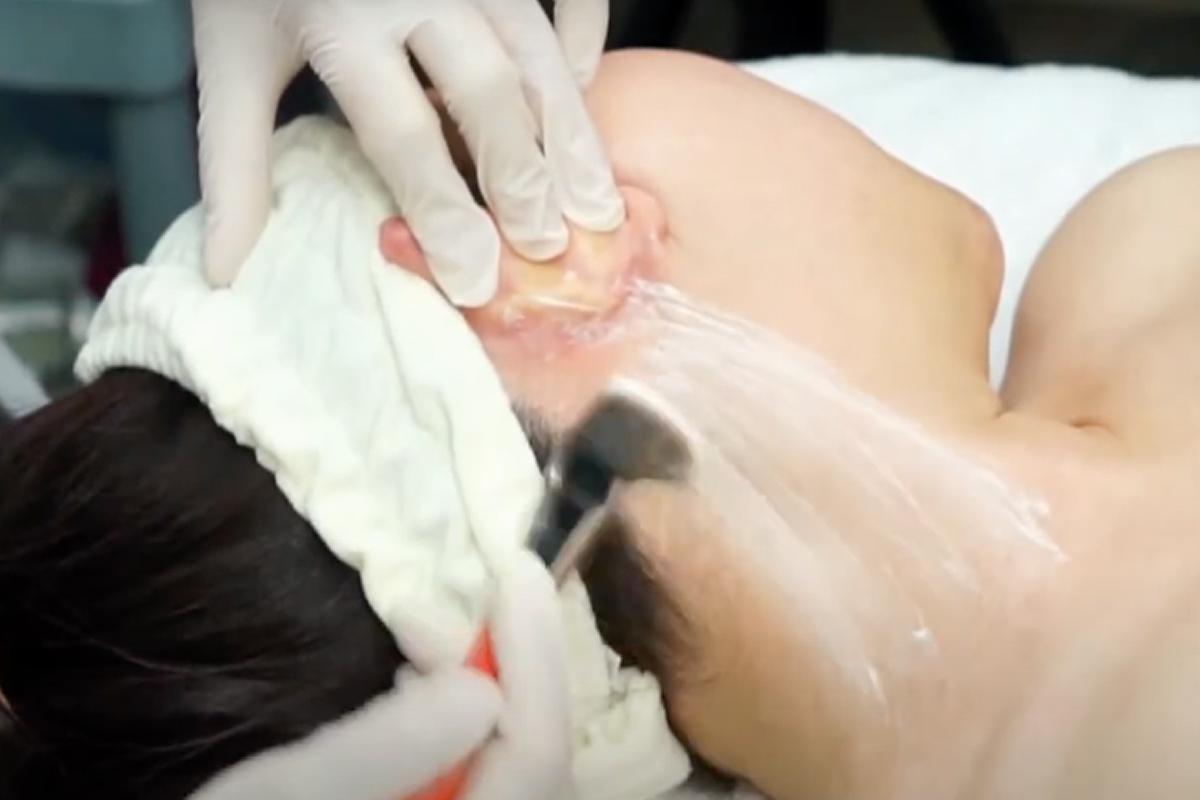 韓国旅行 韓国美容 韓国皮膚科 韓国スキンケア JIWOOCLINIC ソウル 江南 韓国美容旅行