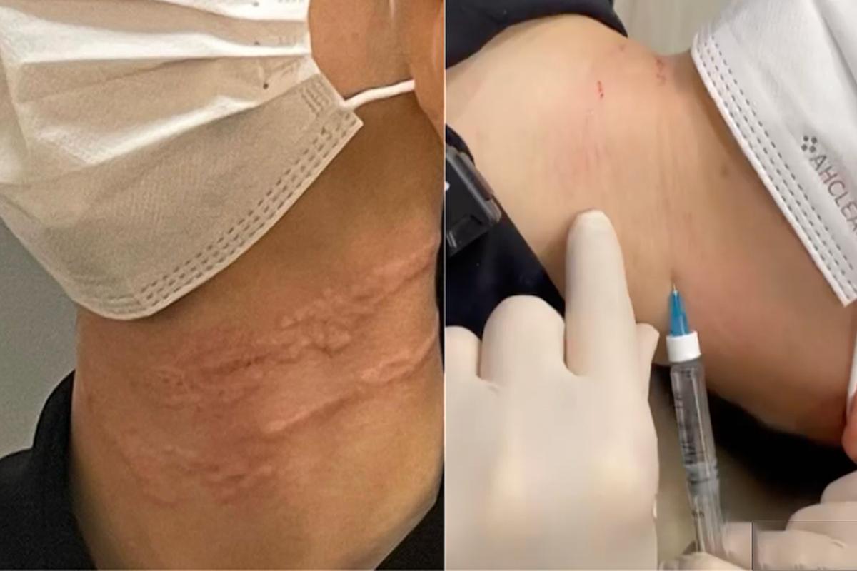 韓国旅行 韓国美容 韓国皮膚科 韓国スキンケア JIWOOCLINIC ソウル 江南 韓国美容旅行