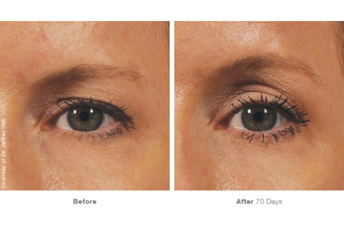 韓国旅行 韓国美容 韓国皮膚科 韓国スキンケア JIWOOCLINIC ソウル 江南 韓国美容旅行