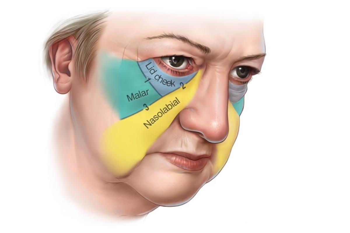 韓国旅行 韓国美容 韓国皮膚科 韓国スキンケア JIWOOCLINIC ソウル 江南 韓国美容旅行