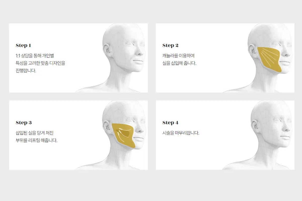 韓國美容 韓國美容中心 江南美容 江南美容中心 LE SHINE CLINIC 埋線拉提 Jamber線