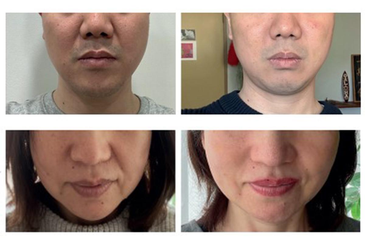 韓國美容 明洞美容中心 韓國護膚療程 韓國減肥療程 韓醫護膚 韓醫減肥 慶熙梅花鹿韓醫院