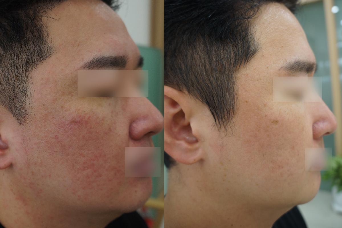 韓國美容 明洞美容中心 韓國護膚療程 韓國減肥療程 韓醫護膚 韓醫減肥 慶熙梅花鹿韓醫院