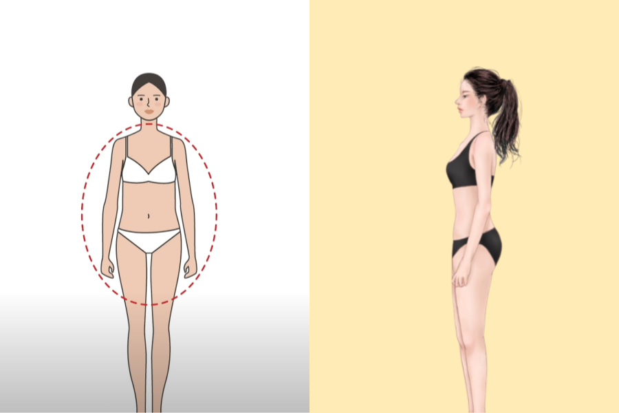 直筒型體型的正面和側面示意圖，強調短頸和具彈性的特徵，以及身材比例。