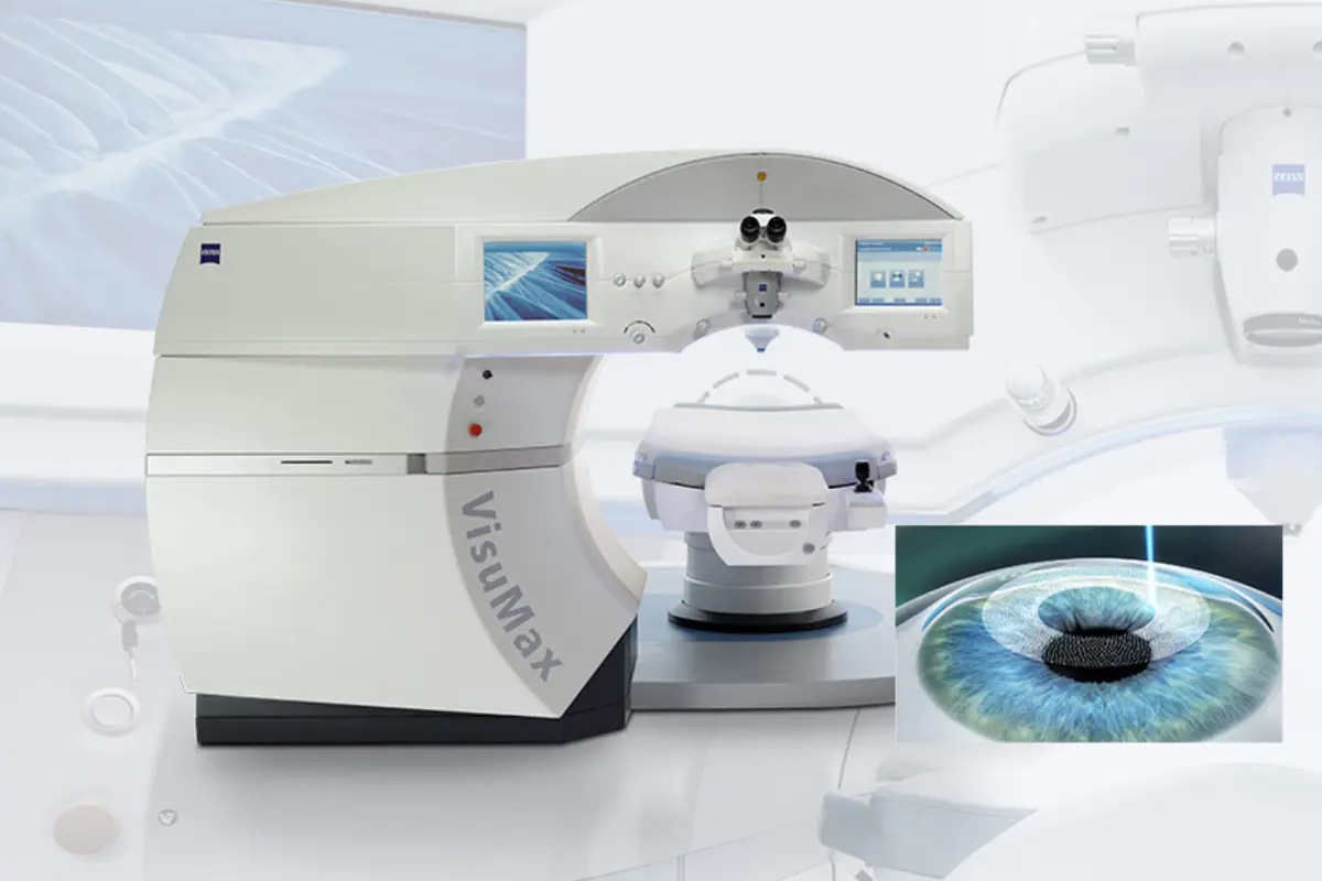 韓國近視雷射 手術 韓國雷射手術推薦 2025 價格 中文服務 韓國雷射近視優點