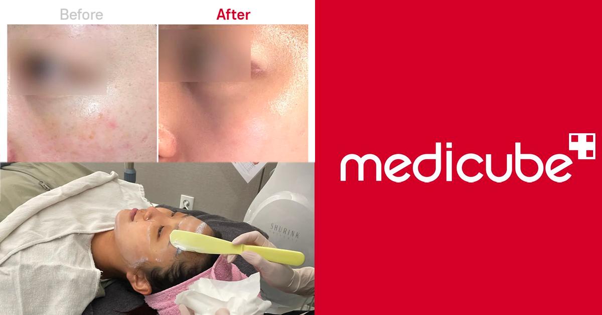 送Medicube產品🎉皮膚管理｜Medicube Clinic(江南)