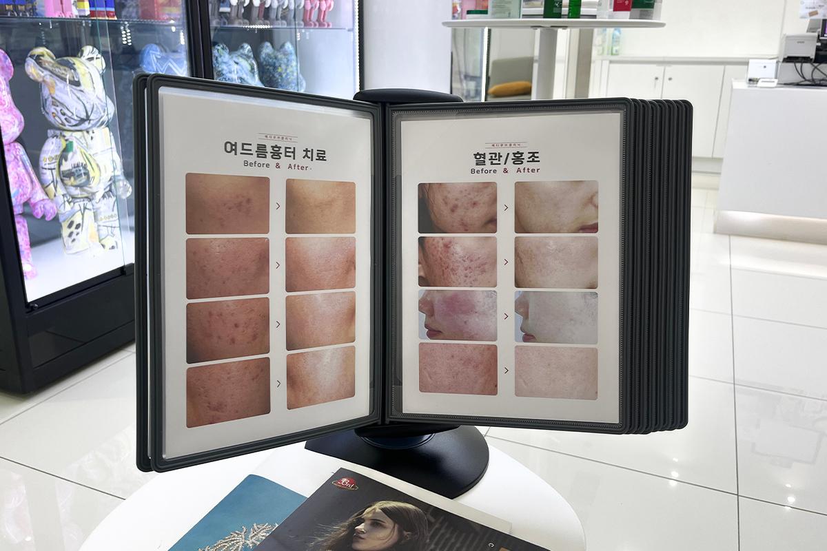 韓國美容 首爾美容中心 江南美容中心 拉提 祛斑 護膚療程 江南 MEDICUBE CLINIC 價錢 預約 推薦 療程簡介