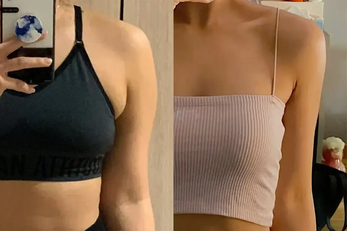 PLANS CLINIC 韓國醫美 江南皮膚管理 韓國拉提 韓國保養 韓國消脂針 韓國溶脂針 鈦金拉提