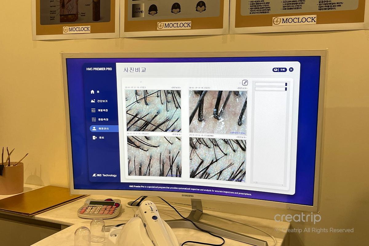 MOCLOCK 韓國頭皮護理 韓國美容 韓國頭皮spa 首爾頭皮護理 首爾頭皮spa 江南頭皮護理 江南頭皮spa 韓國頭皮保養 首爾頭皮保養 江南頭皮保養