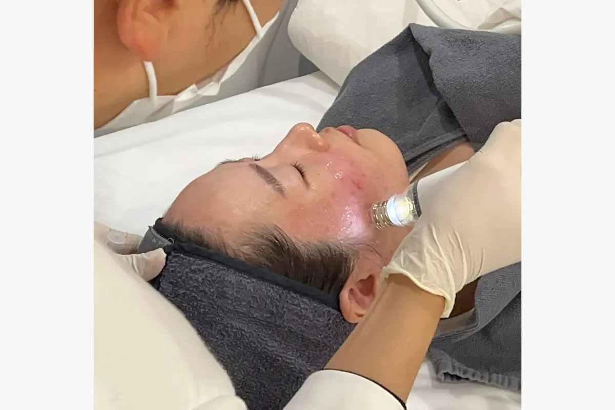 香港人必睇韓國醫美攻略 韓國醫美體驗分享 韓國醫學美容推薦 首爾醫美診所推薦 韓國微整形項目 醫美療程價錢比較 醫學美容口碑評價 韓國皮膚美容雷射 韓國醫美注意事項 韓國醫美流程教學 韓國醫美真實評價 韓國醫美術後護理 韓國醫美價錢透明 首爾醫美預約教學 韓國醫生諮詢重點 韓國醫美熱門療程整理 韓國醫美最新優惠