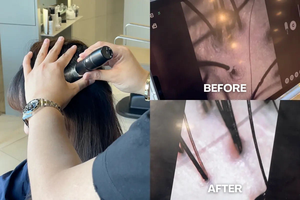 頭皮SPA 韓國頭皮SPA 韓國頭皮水療 韓國美髮 韓國美容 韓國髮型屋 首爾頭皮SPA 頭皮SPA介紹 韓國頭皮SPA推薦 價錢 預約