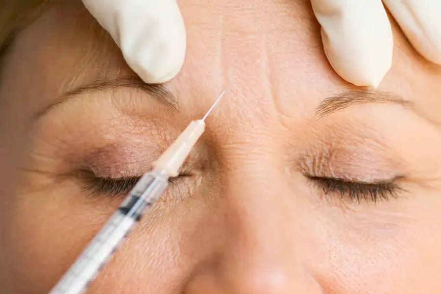 韓國肉毒 打肉毒 韓國產肉毒差別 價格 2025