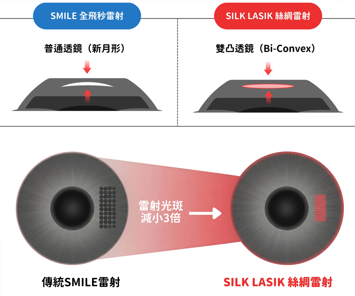 韓國眼科視力矯正設備與手術流程示意圖