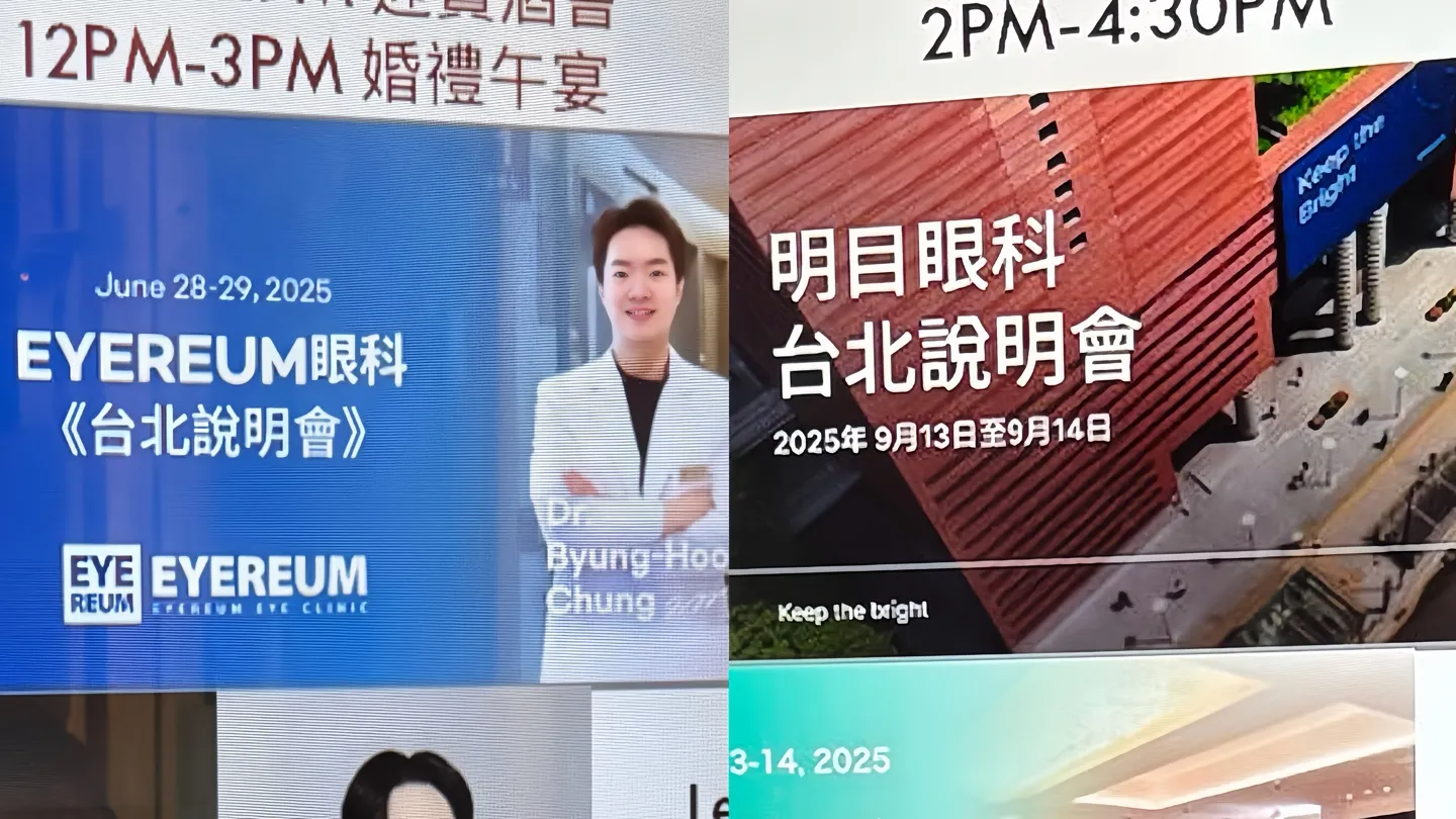 韓國近視雷射種類比較示意圖，包含 Smile、Lasik、Lasek 與 ICL