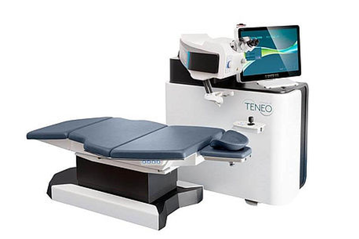 韓國 TENEO 近視雷射手術示意圖片