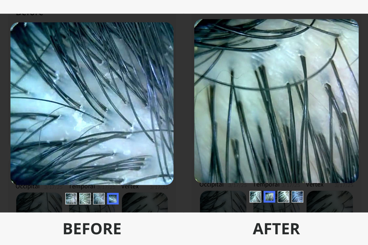 頭皮SPA 韓國頭皮SPA 韓國頭皮水療 韓國美髮 韓國美容 韓國髮型屋 首爾頭皮SPA 頭皮SPA介紹 韓國頭皮SPA推薦 價錢 預約