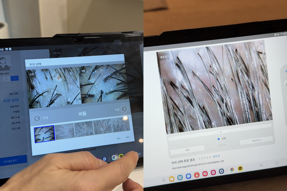 頭皮SPA 韓國頭皮SPA 韓國頭皮水療 韓國美髮 韓國美容 韓國髮型屋 首爾頭皮SPA 頭皮SPA介紹 韓國頭皮SPA推薦 價錢 預約