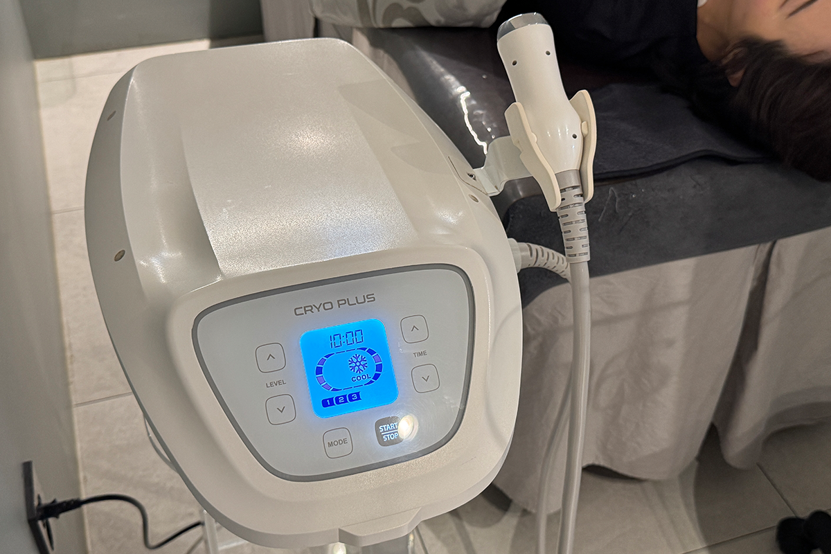 Excel V Laser session using a handheld device for skin blemish removal.