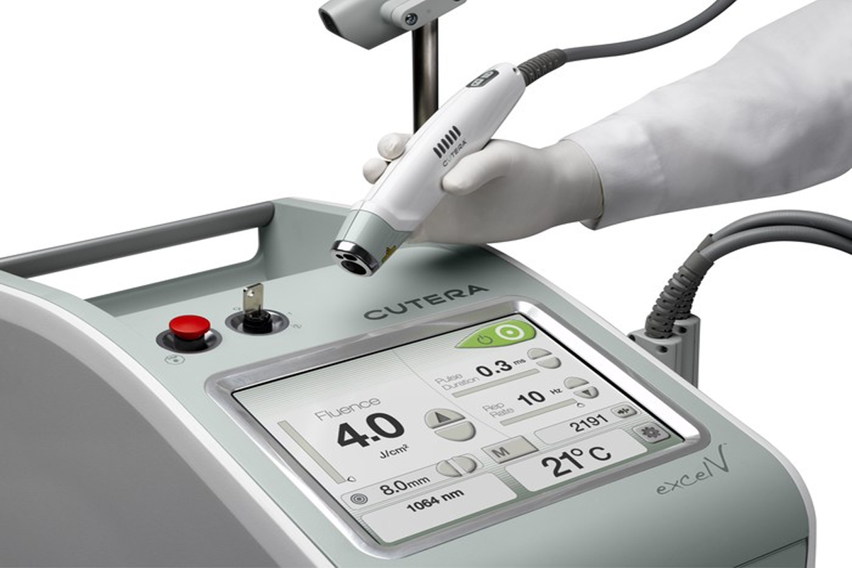 Image of Excel V Laser machine used for treating light skin blemishes such as freckles.