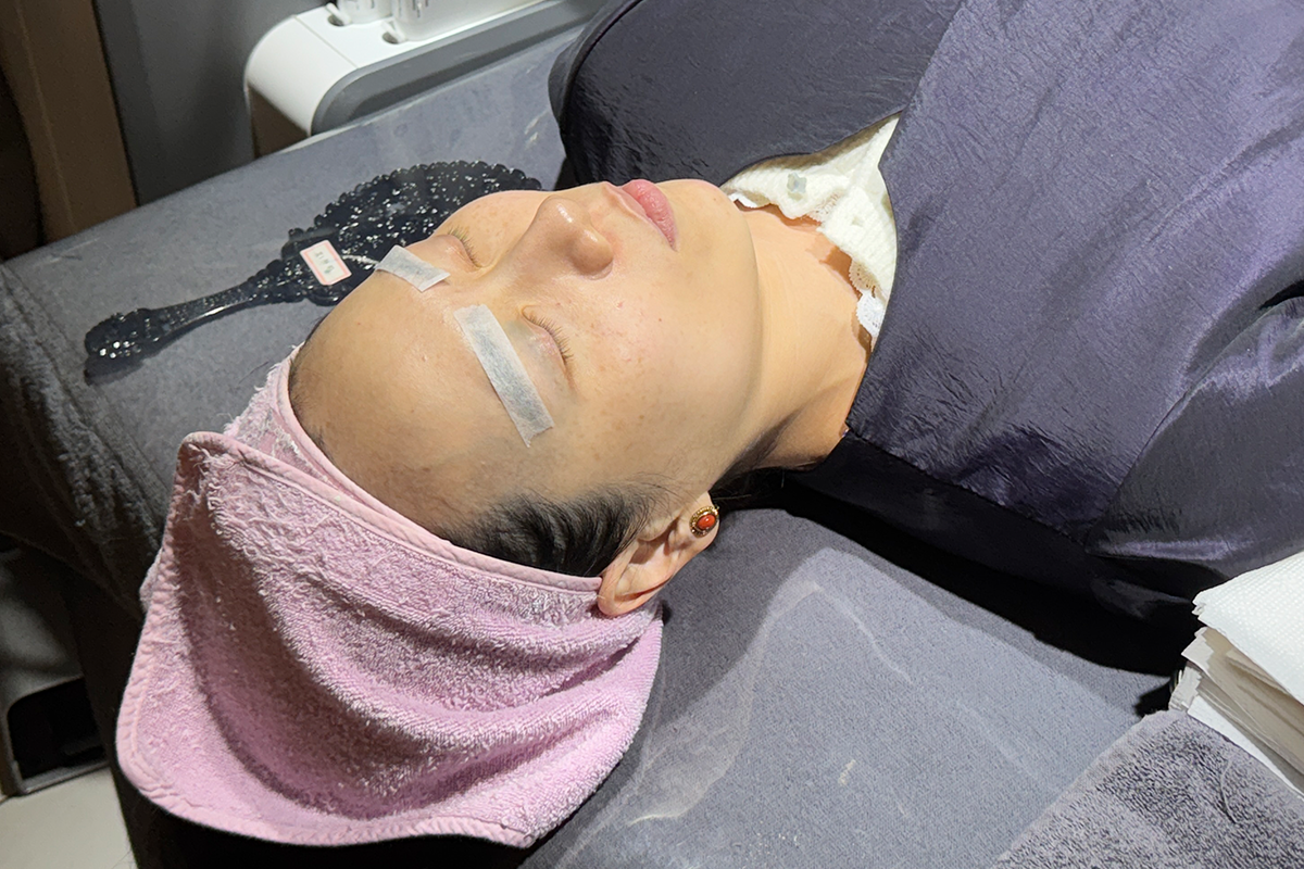 Picotoning laser room setup showing precautions taken for facial treatments.
