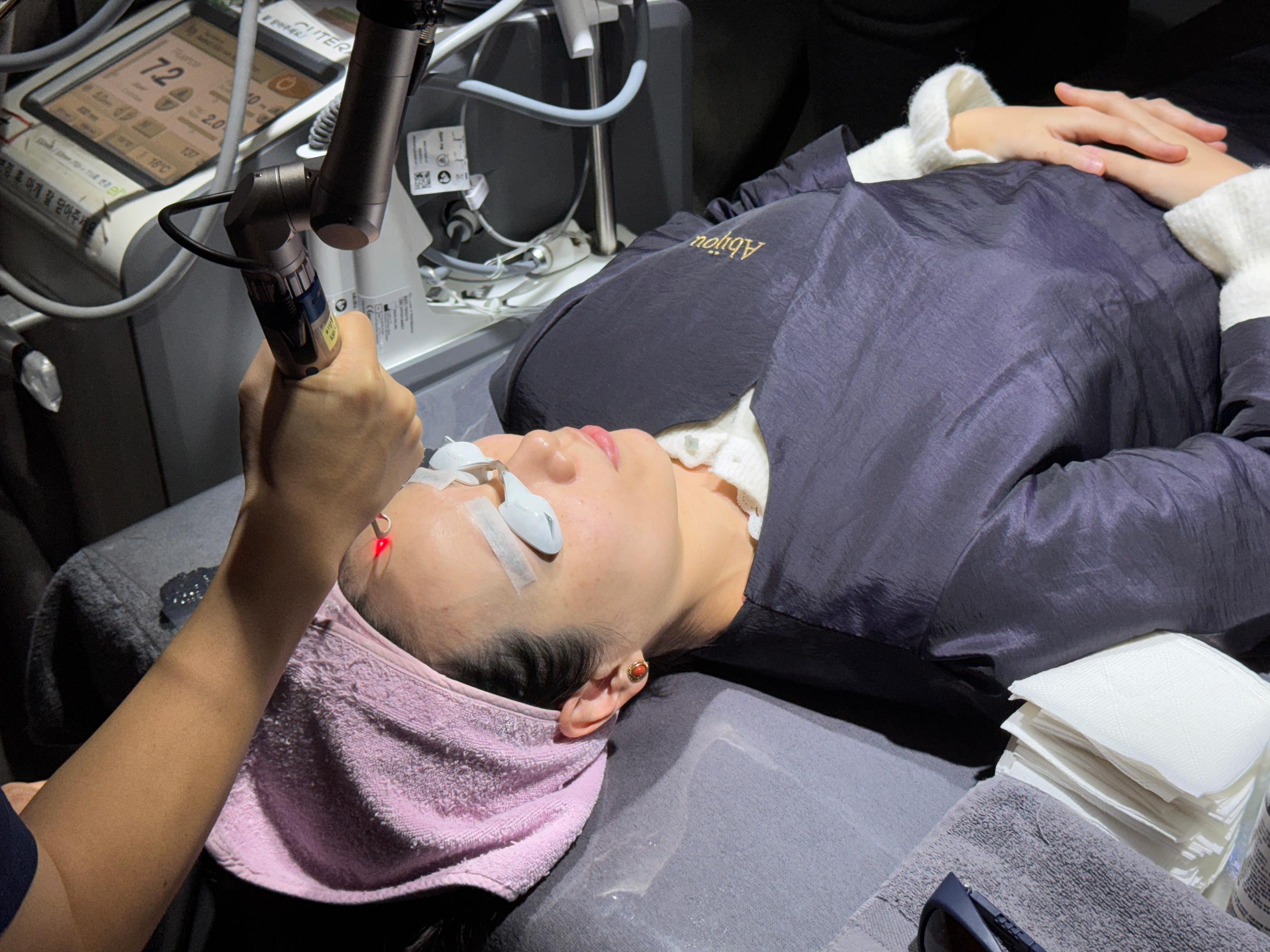 Picotoning laser procedure targeting skin blemishes, using protective measures.