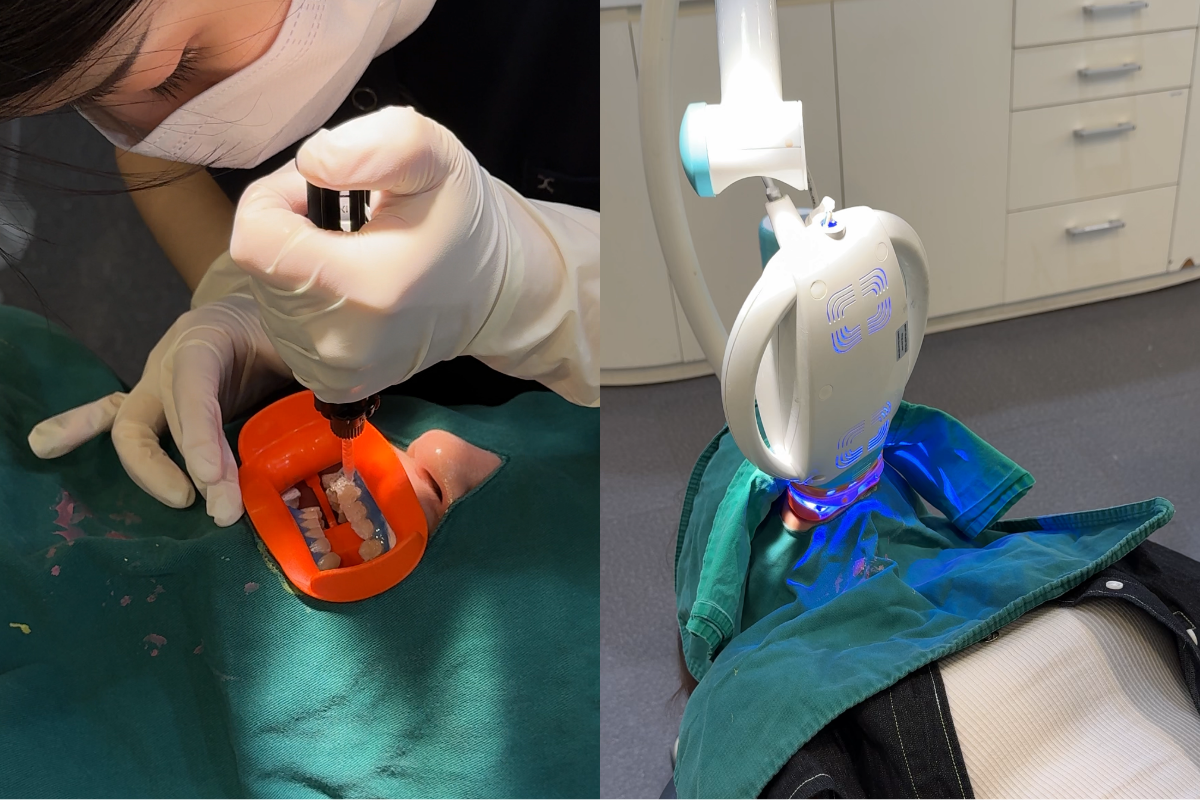 韓國牙齒美白 韓國漂牙 韓國牙齒美白療程 韓國牙科 韓國牙醫 韓國美白牙齒 韓國牙齒護理 韓國牙齒保健 韓國美容 瓷牙貼片 陶瓷牙齒貼片 藍光美白 藍光漂牙 韓國牙科診所推薦 2026價錢 邊間韓國牙科好 韓國牙齒美白有咩好