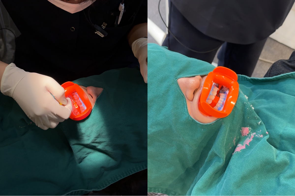 韓國牙齒美白 韓國漂牙 韓國牙齒美白療程 韓國牙科 韓國牙醫 韓國美白牙齒 韓國牙齒護理 韓國牙齒保健 韓國美容 瓷牙貼片 陶瓷牙齒貼片 藍光美白 藍光漂牙 韓國牙科診所推薦 2026價錢 邊間韓國牙科好 韓國牙齒美白有咩好