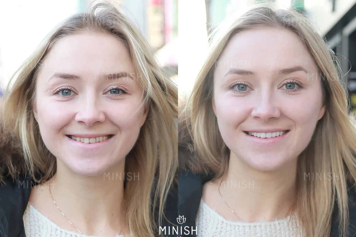 韓國牙齒護理 韓國牙科 韓國牙醫 韓國美白牙齒 陶瓷牙齒貼片 藍光美白 零磨牙陶瓷牙齒貼片 韓國牙齒清潔 韓國牙齒保健 韓國牙齒美白 韓國牙齒矯正 首爾牙科 首爾牙科推薦