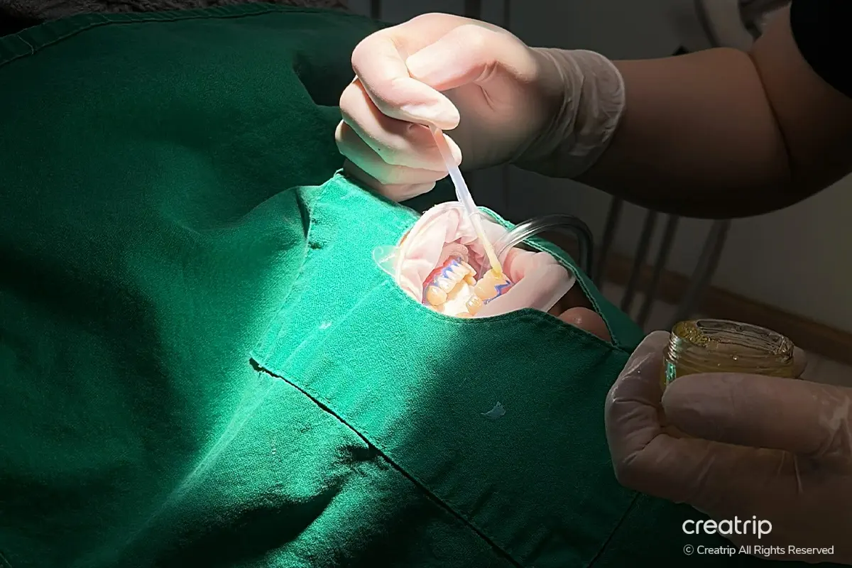 韓國牙齒美白 韓國漂牙 韓國牙齒美白療程 韓國牙科 韓國牙醫 韓國美白牙齒 韓國牙齒護理 韓國牙齒保健 韓國美容 瓷牙貼片 陶瓷牙齒貼片 藍光美白 藍光漂牙 韓國牙科診所推薦 價錢