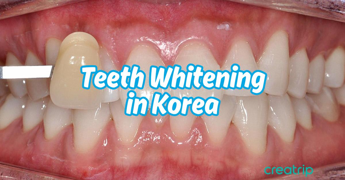 Teeth Whitening in Korea: Costs, Methods, and What to Expect
