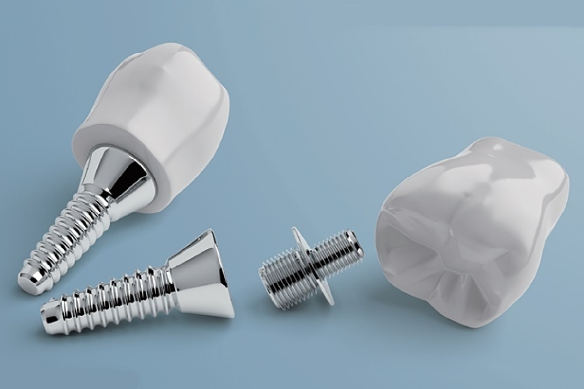 韓國牙科療程 韓國牙醫推薦 韓國牙齒美白 韓國牙齒矯正 韓國口腔健康 韓國牙齒護理 韓國牙科診所 韓國牙科技術 韓國牙科保健 韓國醫療旅遊 韓國漂牙