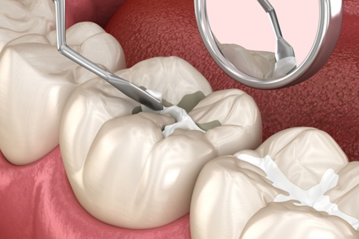 Korean dentistry dental procedures dental clinic recommendations Korean teeth whitening Korean dental cleaning dental checkup Korean fillings Korean dentists dental care Korean dental cosmetics Korean porcelain veneers Korean front-tooth veneers recommended Korean dental clinics Korean dental prices