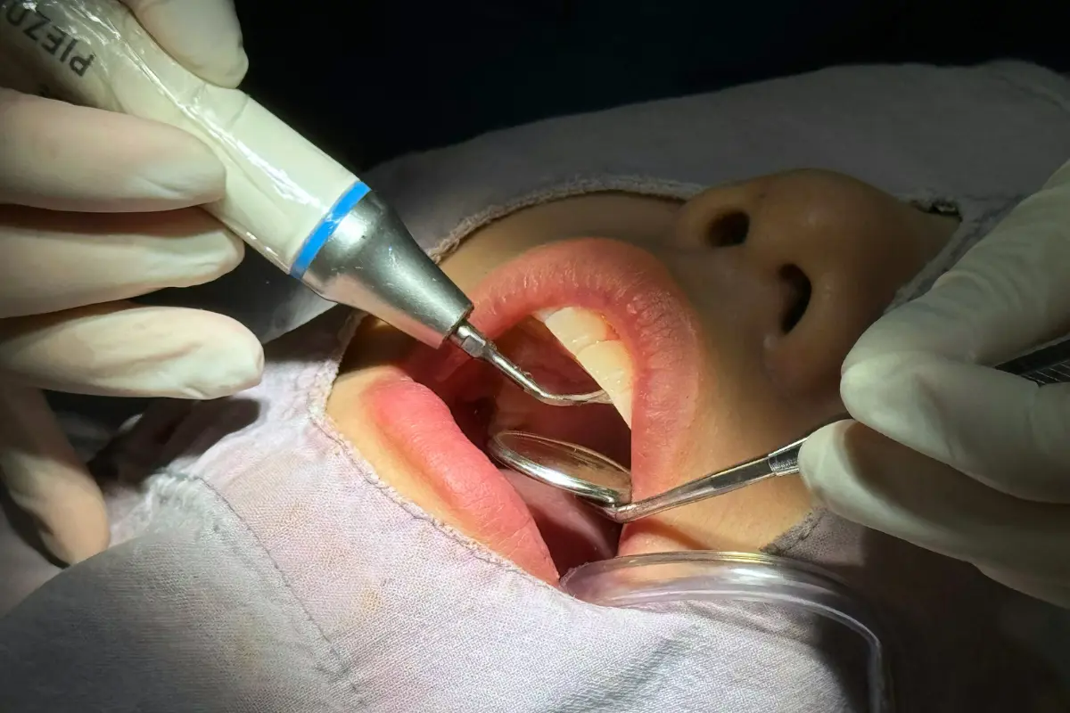 Korean dentistry dental procedures dental clinic recommendations Korean teeth whitening Korean dental cleaning dental checkup Korean fillings Korean dentists dental care Korean dental cosmetics Korean porcelain veneers Korean front-tooth veneers recommended Korean dental clinics Korean dental prices