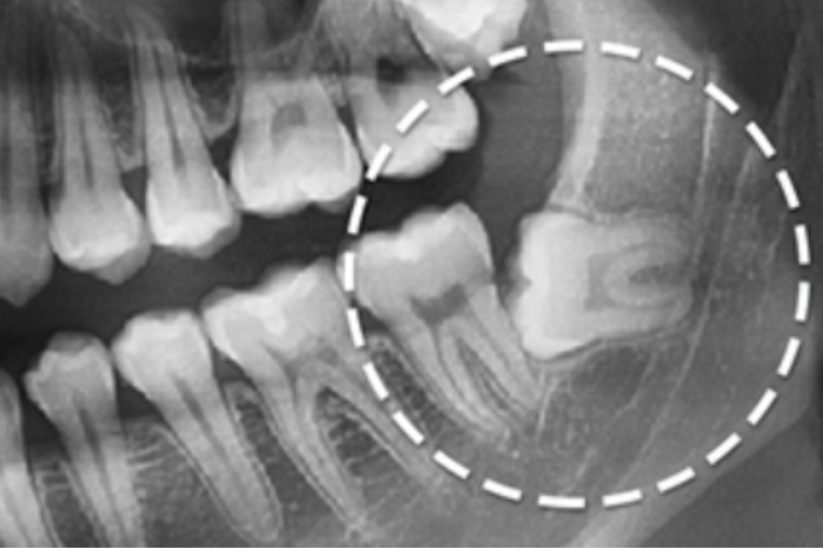 牙科知識 牙科療程 牙科迷思 牙科錯誤認知 牙齒健康 牙科常見問題 韓國牙科 牙科護理 牙科檢查 韓國牙科療程 韓國牙科診所