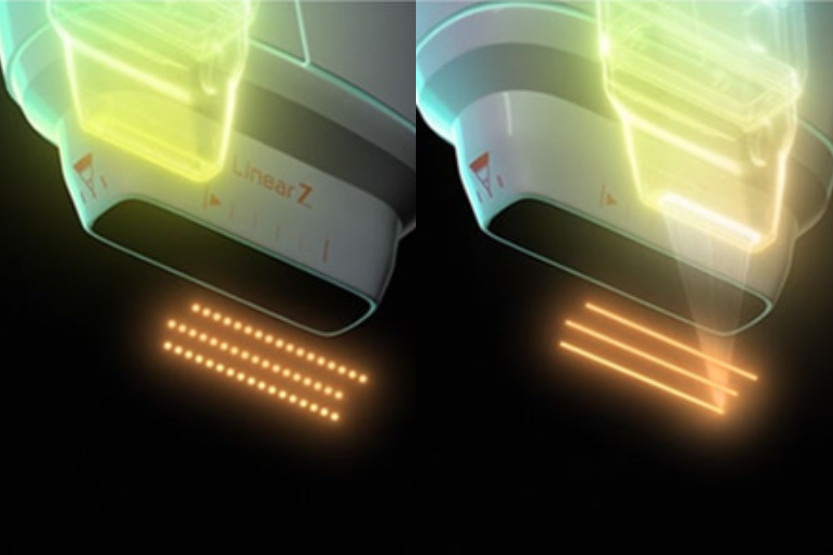 No downtime Korean medical aesthetic treatments recommended  No recovery period aesthetic procedures  Same-day Korean medical aesthetic treatments  No downtime skin laser  Korean skin booster injection treatments  Korean minimally invasive aesthetic procedures with no downtime  Medical aesthetic treatment price comparison  Authentic reviews of Korean medical aesthetics  Korean medical aesthetic guide for Hong Kong people  Lifting  Skin booster injection  Skincare  Whitening