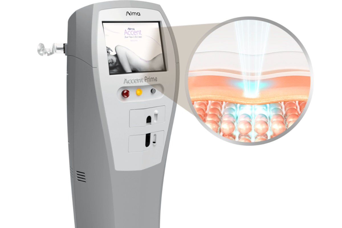 Recommended no-downtime Korean medical aesthetic treatments  No-downtime aesthetic procedures  Same-day Korean medical aesthetics  No-downtime skin laser  Korean skin booster treatment  No-downtime Korean minimally invasive procedures  Medical aesthetic treatment price comparison  Authentic reviews of Korean medical aesthetics  Korean medical aesthetics guide for Hong Kong people  Lifting  Skin booster  Skincare  Whitening