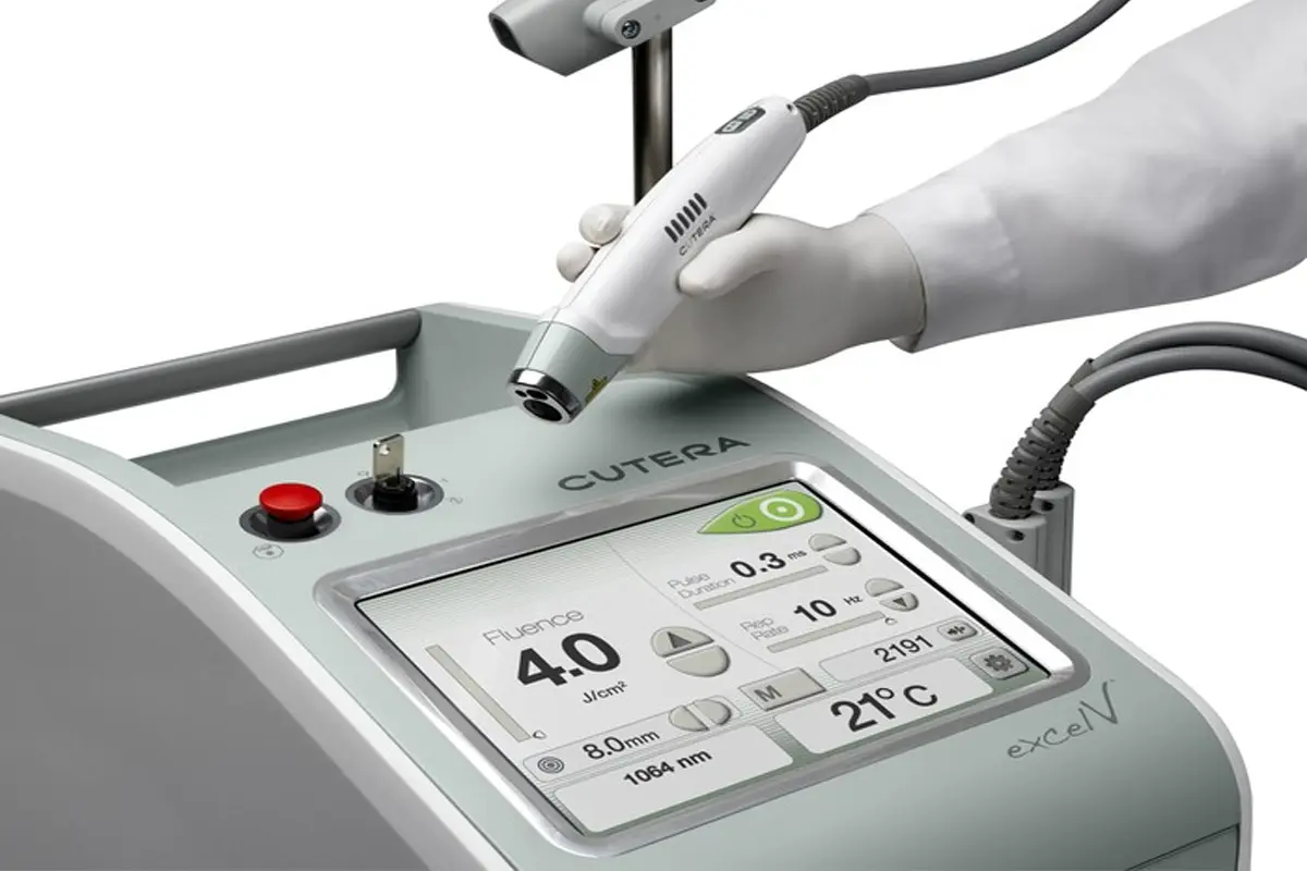 Image of Excel V Laser machine used for treating light skin blemishes such as freckles.