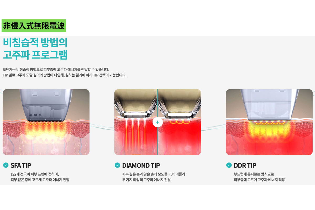 韓國 黃金微針 Potenza 療效 價錢 探頭 推薦診所