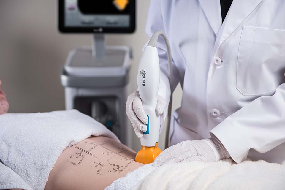 韓國鳳凰電波 價格 價差 美版電波 熱瑪吉效果 韓國醫美