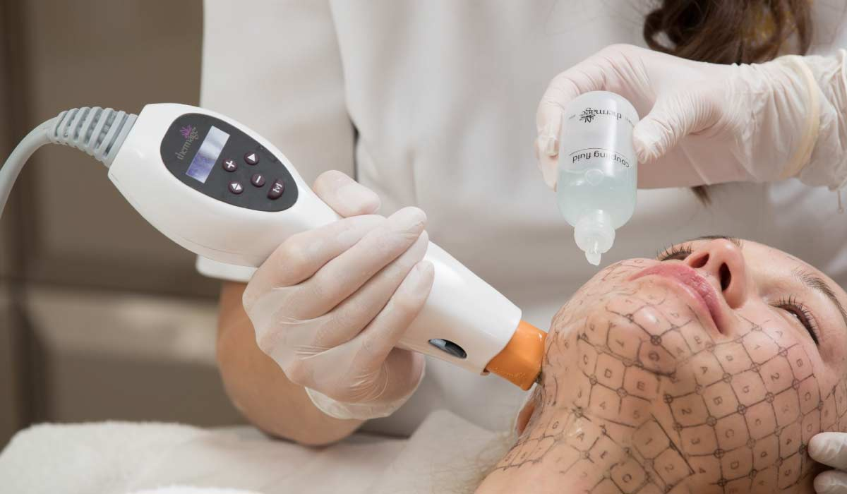 韓國鳳凰電波 價格 價差 美版電波 熱瑪吉效果 韓國醫美